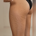 Celuform